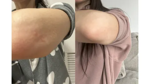 Решение для сглаживания программных услуг