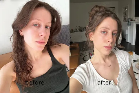   Τζέιμι's before/after results with NuFACE