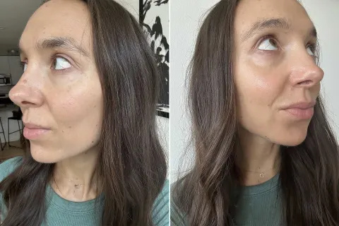 's skin after using the day cream dwa zdjęcia redaktora's skin after using the day cream