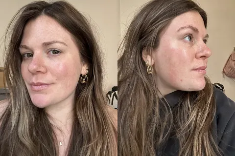   side om side af profilen af ​​kvinden efter brug af bon charge rødt lys maske